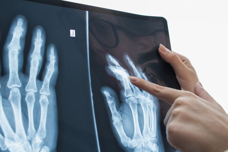 大阪で広がる笑顔の秘訣豊富な実績で選ばれるワイヤー歯科矯正の魅力と健康効果